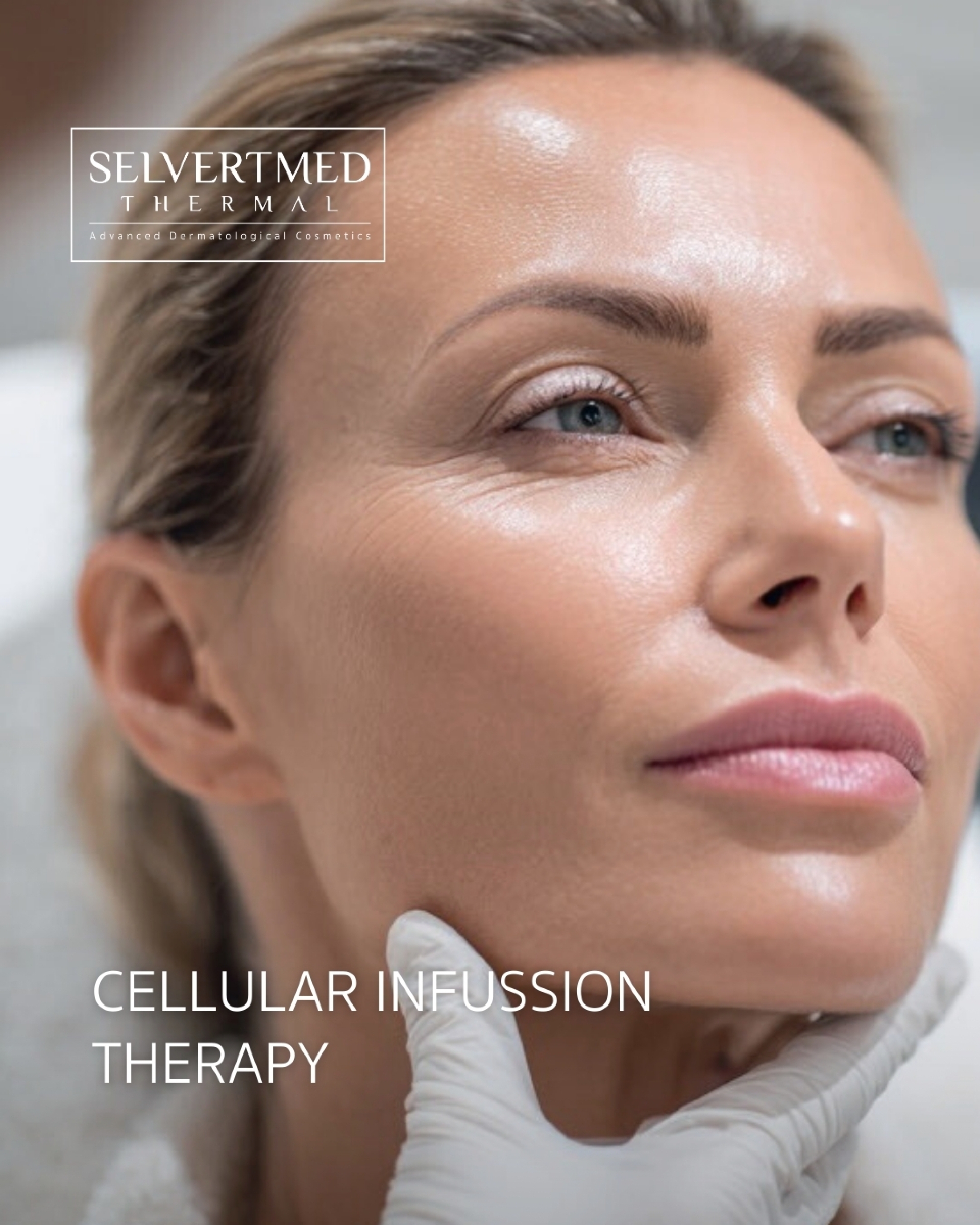 <p>Each formula has been designed to integrate safely with various <strong>transdermal delivery</strong> systems such as microneedling, maximising the penetration and effectiveness of the active ingredients. Moreover, all ingredients used are <strong>backed by scientific evidence</strong>, guaranteeing their biocompatibility, effectiveness and tolerance even on sensitive or compromised skin.</p>
<p>Selvert Thermal MED represents the convergence of science and advanced cosmetic dermatology, restoring the skin’s <strong>optimal functionality</strong> through a therapeutic and personalised approach. A new era of regeneration where biological intelligence is applied to cosmetics.</p>
<p></p>
<p><strong><span>CELLULAR INFUSION THERAPY   </span></strong></p>
<p>An exclusive method designed to increase the effectiveness of procedures focused on regenerative aesthetics with microneedling + electroporation as a therapeutic synergy for cellular biostimulation.</p>
<p><span>The combination of exosomes with cosmetic active ingredients enhances results thanks to a synergy in the interaction of cellular mechanisms:</span></p>
<ul style="list-style-type: undefined;">
<li><span>Enhanced skin regeneration</span></li>
<li><span>Reduced irritating side effects typical of some active ingredients</span></li>
<li><span>Improved effectiveness in the treatment of melasma</span></li>
<li><span>Greater bioavailability and penetration of active ingredients</span></li>
<li><span>Complementary antioxidant action</span><strong><span>                                                                                                                        </span></strong></li>
</ul>